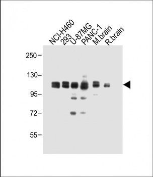 XYLT1 Antibody (N-term)