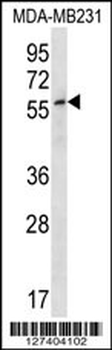 ZNF506 Antibody (N-term)
