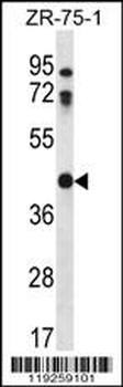 CTSO Antibody (N-term)