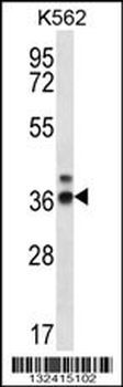 RPP38 Antibody (C-term)
