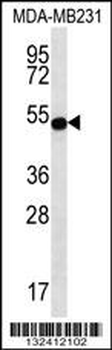 STAP2 Antibody (Center)