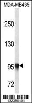PLOD3 Antibody (N-term)