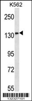 MN1 Antibody (Center)