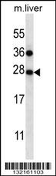 TM4SF1 Antibody (N-term)