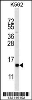 HIST1H2BL Antibody (N-term)