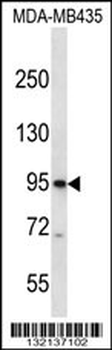 CNGB3 Antibody (N-term)