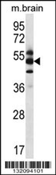 GPS1 Antibody (Center)