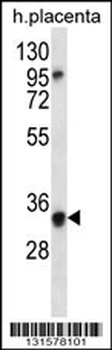 OR6N2 Antibody (C-term)