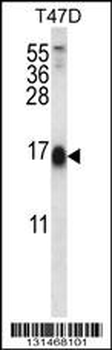 SKA2 Antibody (N-term)
