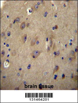 CNRP1 Antibody (Center)