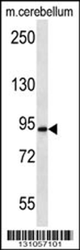 APBA2 Antibody (Center)