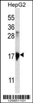 KRTAP1-3 Antibody (Center)
