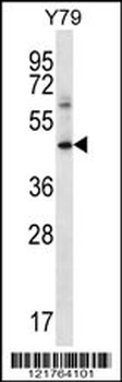 IFNGR1 Antibody (C-term)