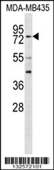 RFX3 Antibody (C-term)