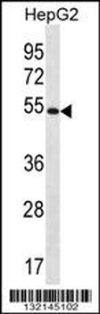 MGAT4C Antibody (C-term)