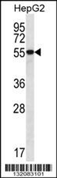 UGDH Antibody (C-term)
