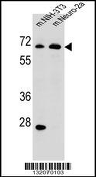 ME2 Antibody (C-term)