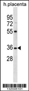 OR5AN1 Antibody (C-term)
