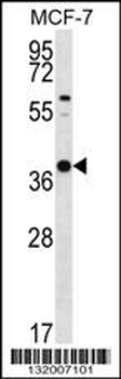 YIF1B Antibody (N-term)