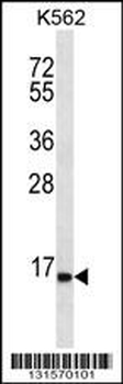 SPINK8 Antibody (C-term)