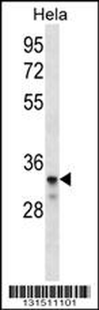LDLRAD2 Antibody (Center)