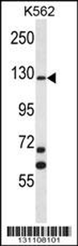 MCF2 Antibody (C-term)