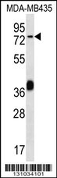 CEL Antibody (Center)