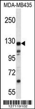 K1324 Antibody (C-term)