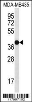 CD271 Antibody (C-term)