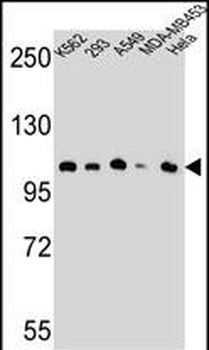 LRRD1 Antibody (C-term)