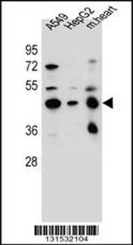 LRRC28 Antibody (C-term)