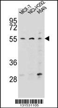 ZNF117 Antibody (N-term)