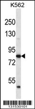 ABTB2 Antibody (C-term)