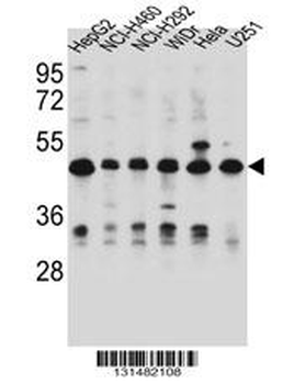 DUS1L Antibody (C-term)