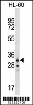 OR6K2 Antibody (C-term)