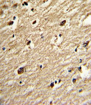 PIASy1 Antibody (C-term)