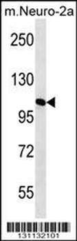 MAN2A2 Antibody (Center)