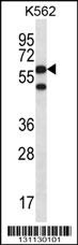 CCT8 Antibody (C-term)