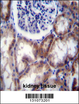 HYAL2 Antibody (Center)