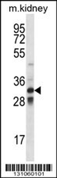 TLX1 Antibody (Center)