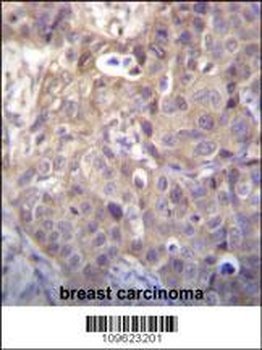 HIPK1 Antibody (C-term)