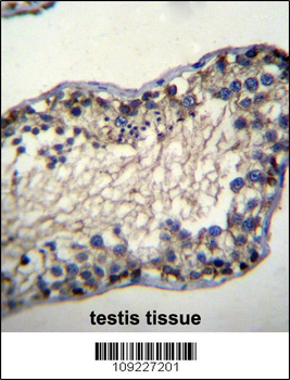 TSSK6 Antibody (N-term)