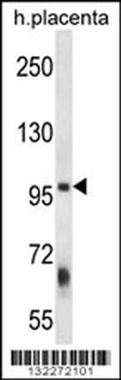 ZFYVE1 Antibody (N-term)