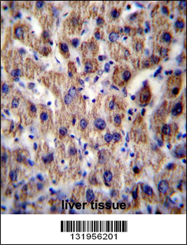 ATP5J Antibody (Center)