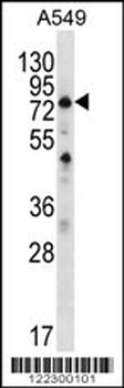 SPATA7 Antibody (C-term)