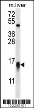 MYCBP Antibody (N-term)
