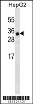 ANR46 Antibody (N-term)