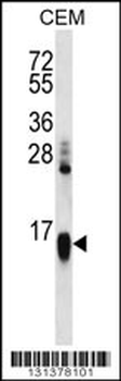 HIST1H2AA Antibody (N-term)