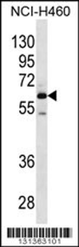 MEPE Antibody (N-term)
