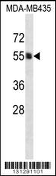 PIGA Antibody (C-term)